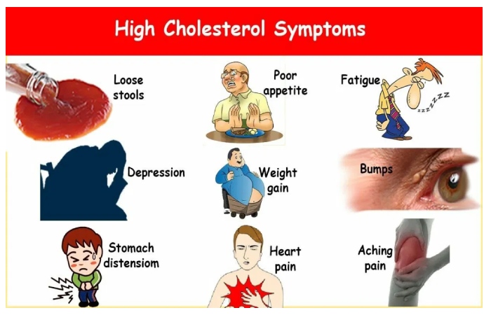 Symptoms Of High Cholesterol