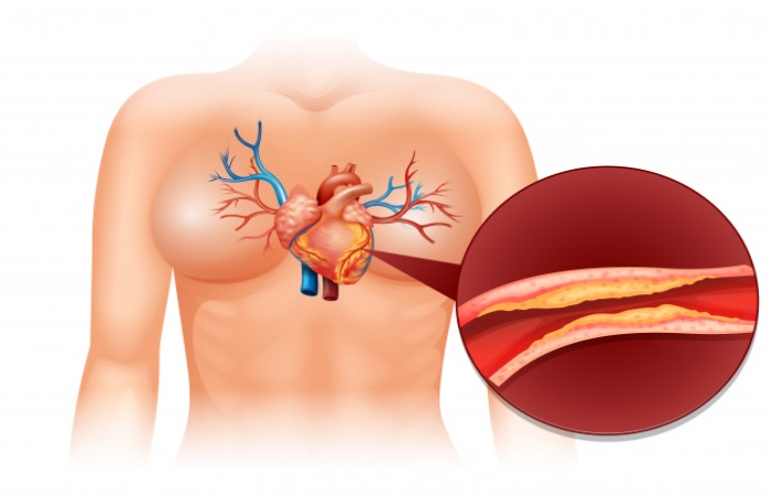 What is Cholesterol