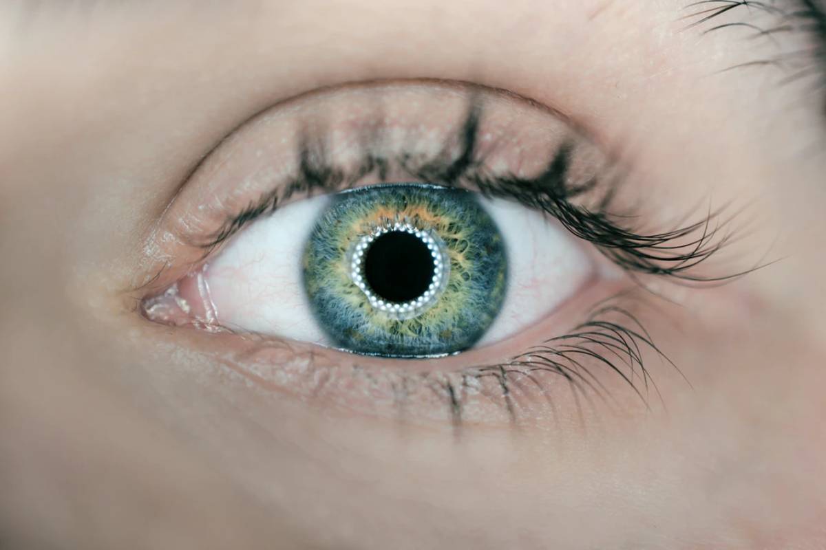 Lenses