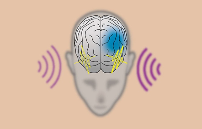 Auditory Illusions