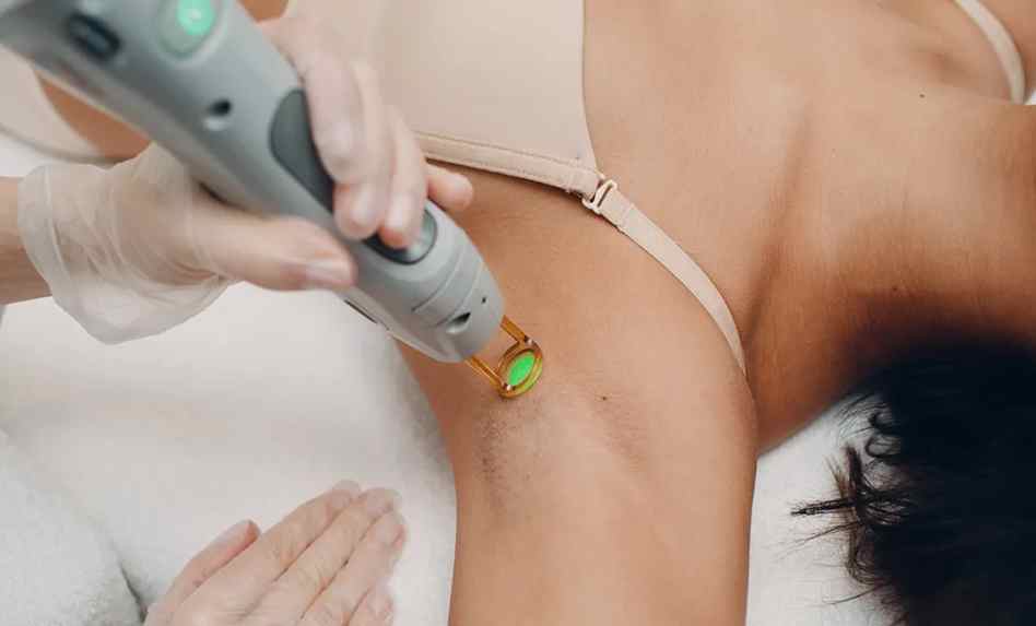 Everything You Wanted To Know About Laser Hair Removal