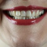 Mouth