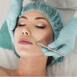 Fractional Laser Resurfacing