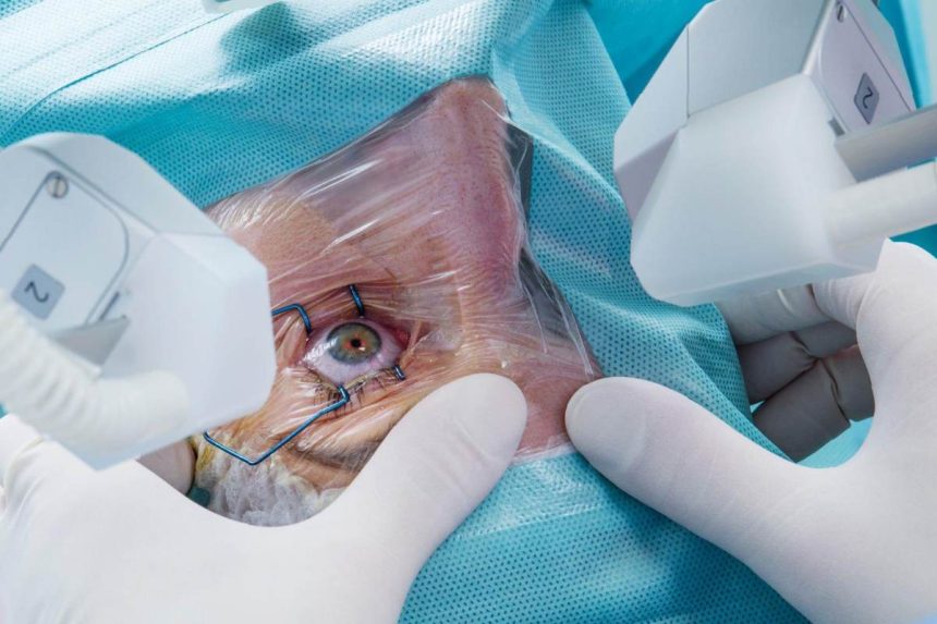 Modern Cataract surgery