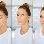 How Do Kybella Treatments Work_