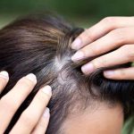 Wellhealthorganic.Com/Know-The-Causes-Of-White-Hair-And-Easy-Ways-To-Prevent-It-Naturally