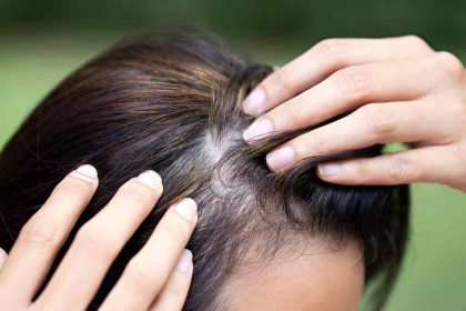 Wellhealthorganic.Com/Know-The-Causes-Of-White-Hair-And-Easy-Ways-To-Prevent-It-Naturally