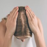 Female Alopecia_ Causes And Treatment