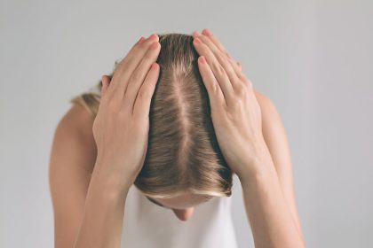 Female Alopecia_ Causes And Treatment